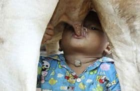 صورة غلاف مقالة طفل يرضع من ثدي بقرة بعد أن هجرته أمّه