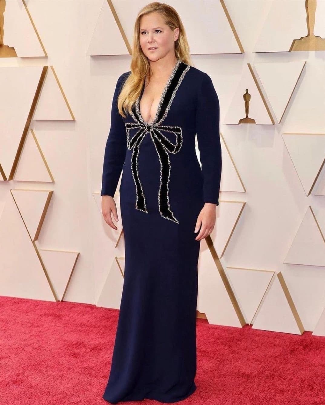 صورة غلاف مقالة إيمي شومر تكشف تفاصيل رحلتها الصحية وتعافيها من جراحة الظهر